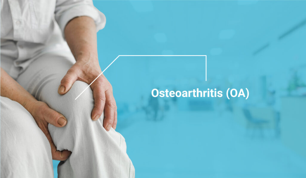 Osteoarthritis (OA)