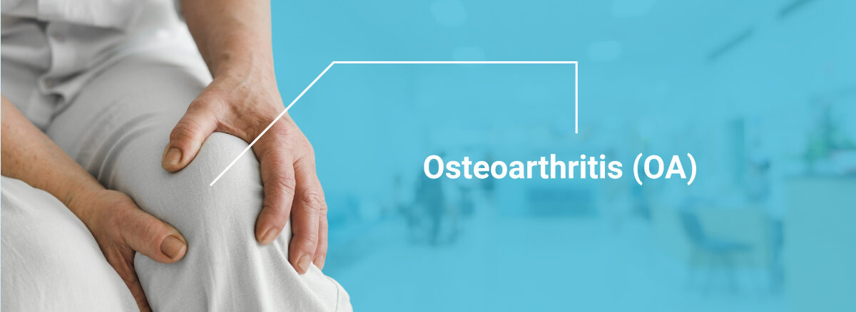 Osteoarthritis (OA)