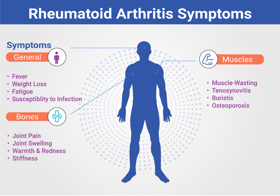 Signs and Symptoms of Rheumatoid Arthritis