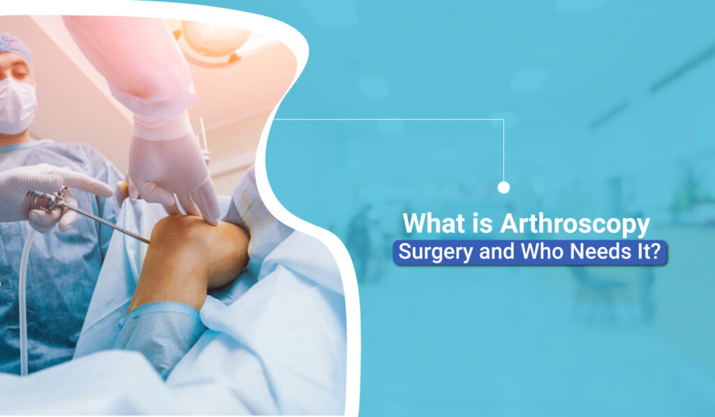 What is Arthroscopy Surgery and Who Needs It