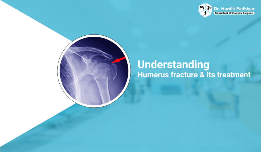 Understanding humerus fracture and its treatment