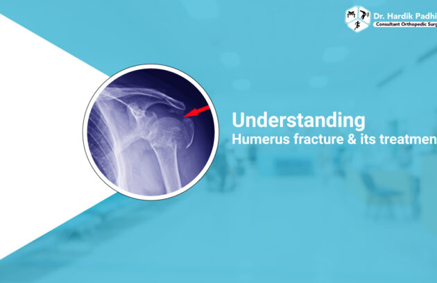 Understanding humerus fracture and its treatment