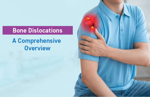 bone dislocations