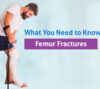 femur fracture