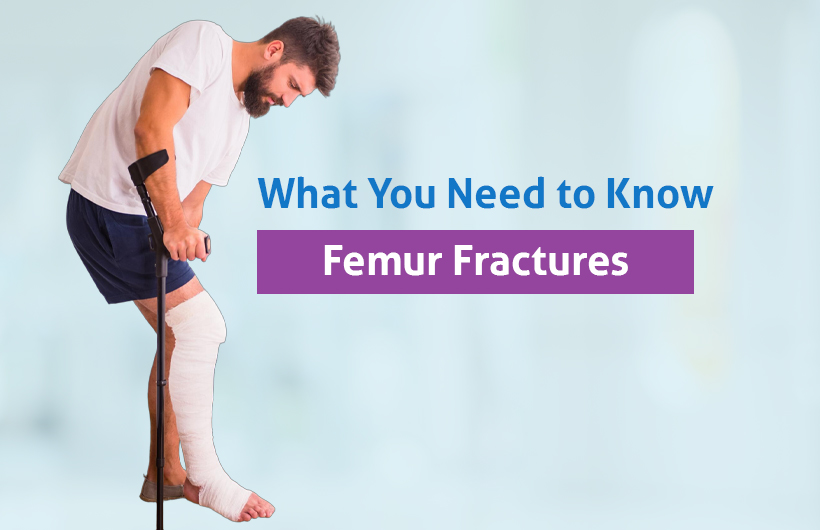 Femur Fractures: What You Need to Know