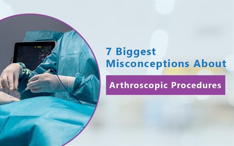 knee arthroscopy myths