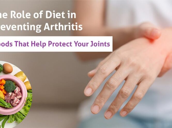 Diet for Arthritis