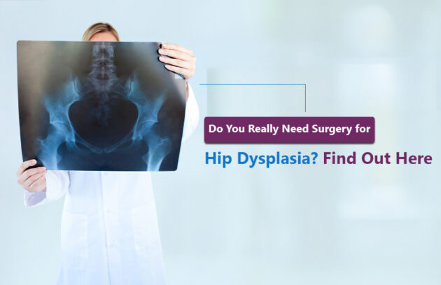 hip dysplasia