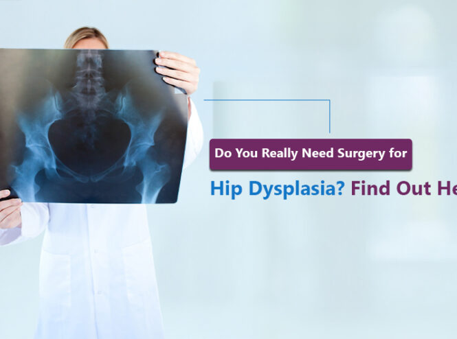 hip dysplasia