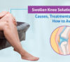 swollen knee solutions