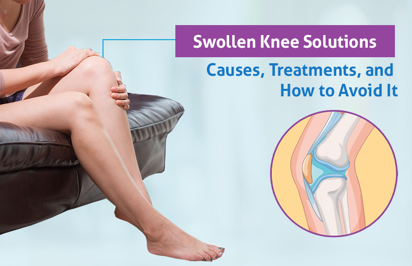 swollen knee solutions