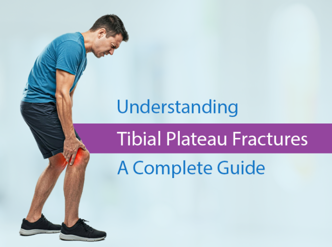 tibial plateau fractures