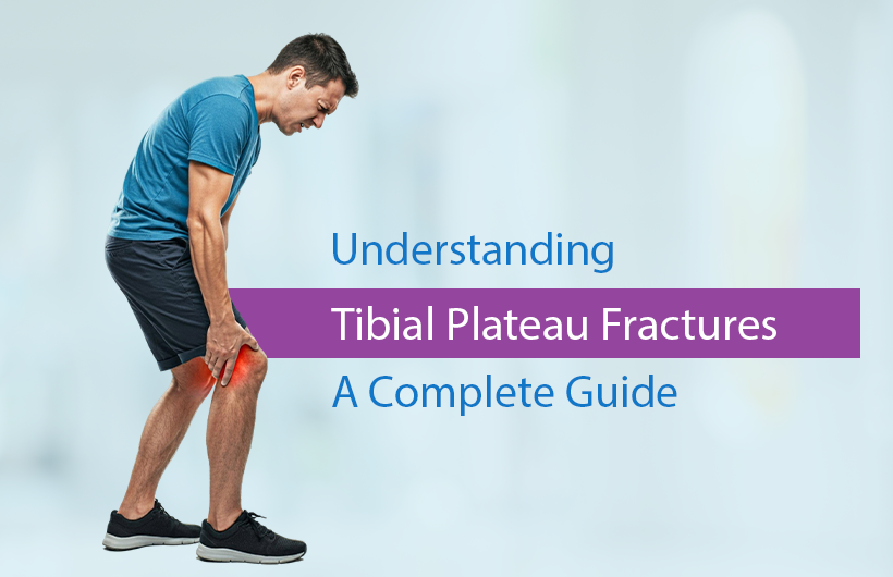 tibial plateau fractures