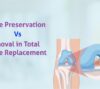 bone preservation vs. removal