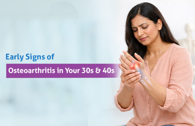 signs of osteoarthritis