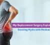 hip replacement myths