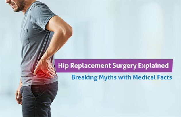 hip replacement myths