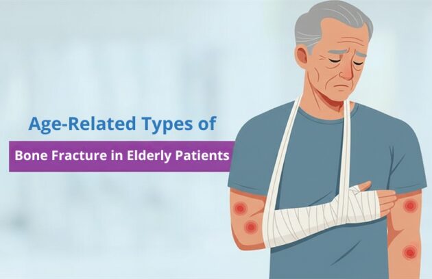 types of bone fracture