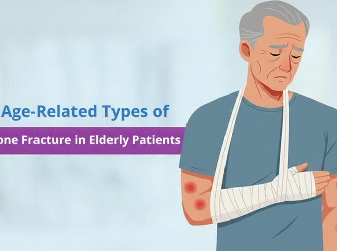 types of bone fracture