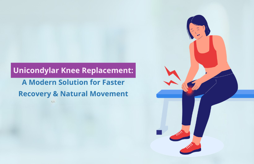 unicodylar knee replacement