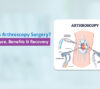 Arthroscopy Surgery Procedure and Benefits