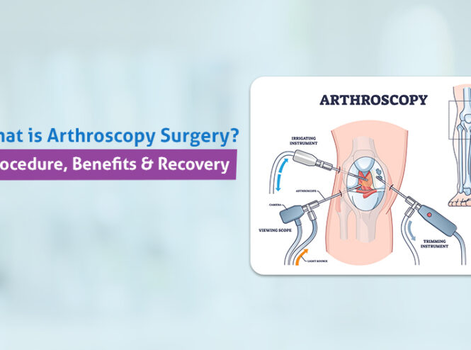 Arthroscopy Surgery Procedure and Benefits