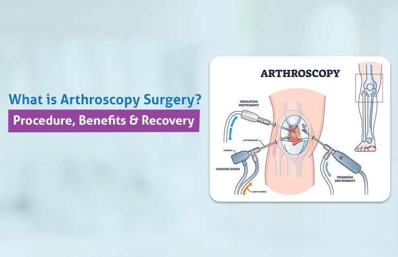 Arthroscopy Surgery Procedure and Benefits