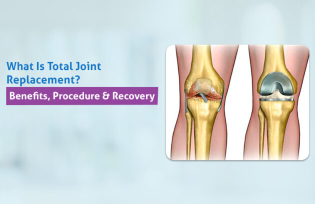Joint Replacement Surgery