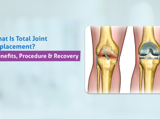 Total Joint Replacement