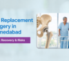 Hip Replacement Surgery in Ahmedabad