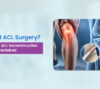 ACL reconstruction surgery in Ahmedabad