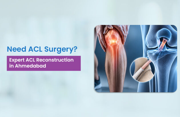 ACL reconstruction surgery in Ahmedabad