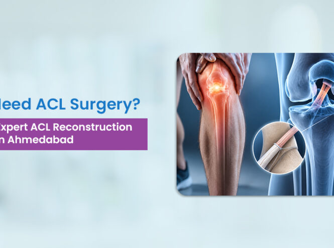 ACL reconstruction surgery in Ahmedabad