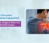 Frozen Shoulder Treatment in Ahmedabad