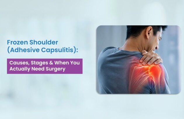 Frozen Shoulder Treatment in Ahmedabad