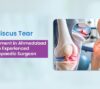 Meniscus Tear Treatment in Ahmedabad
