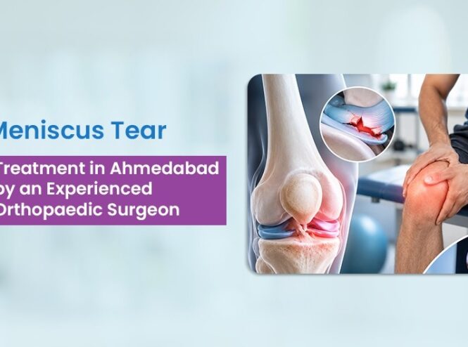 Meniscus Tear Treatment in Ahmedabad