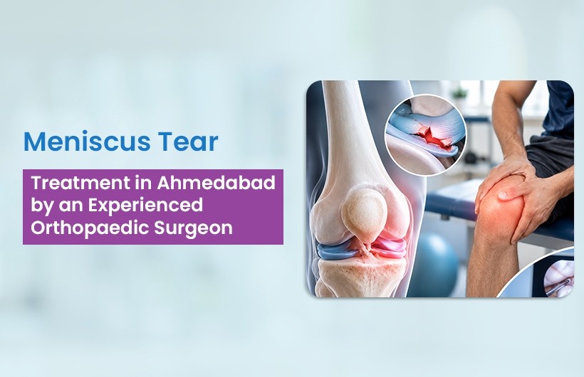 Meniscus Tear Treatment in Ahmedabad