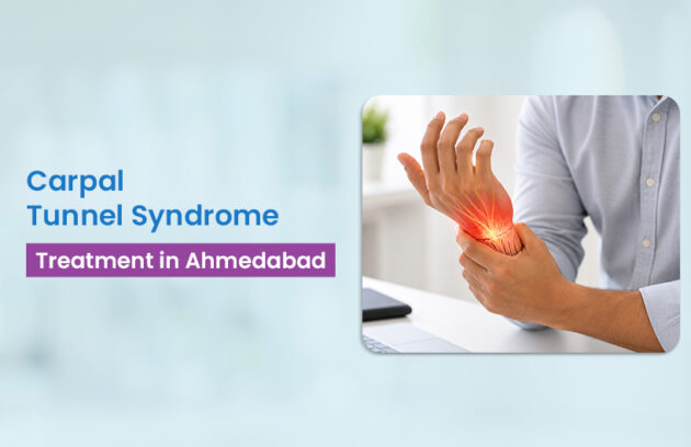 carpal tunnel syndrome treatment Ahmedabad