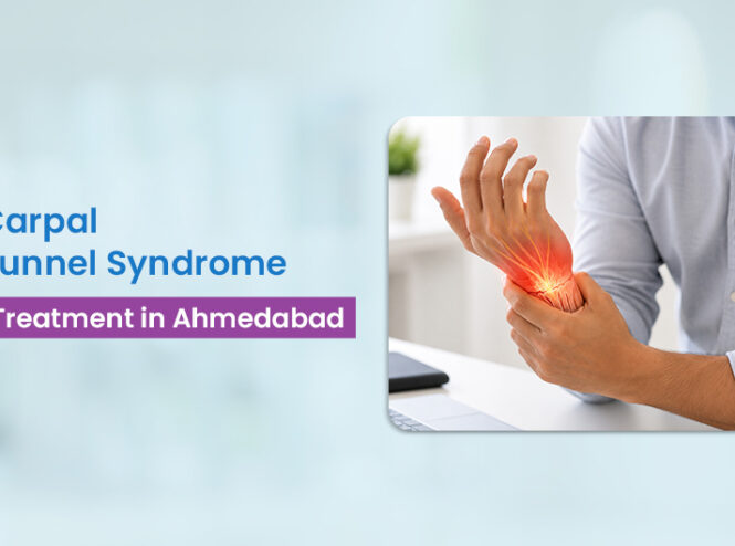 carpal tunnel syndrome treatment Ahmedabad