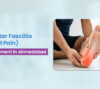 plantar fasciitis treatment Ahmedabad