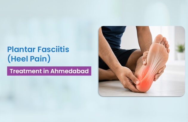 plantar fasciitis treatment Ahmedabad