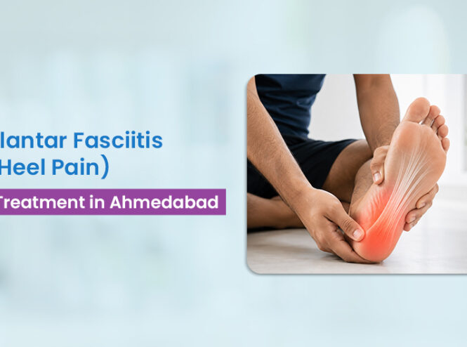 plantar fasciitis treatment Ahmedabad