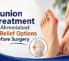 Bunion Treatment in Ahmedabad