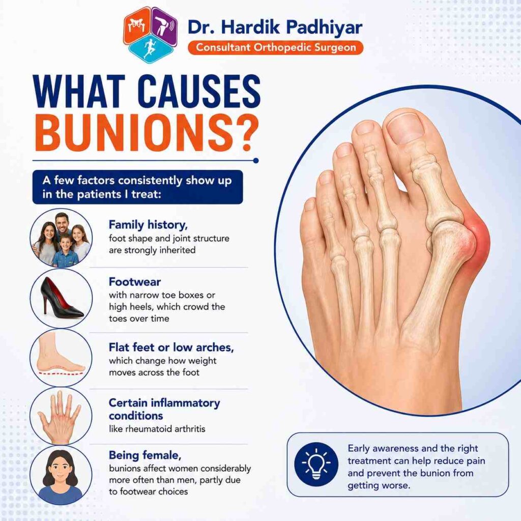 What Causes Bunions