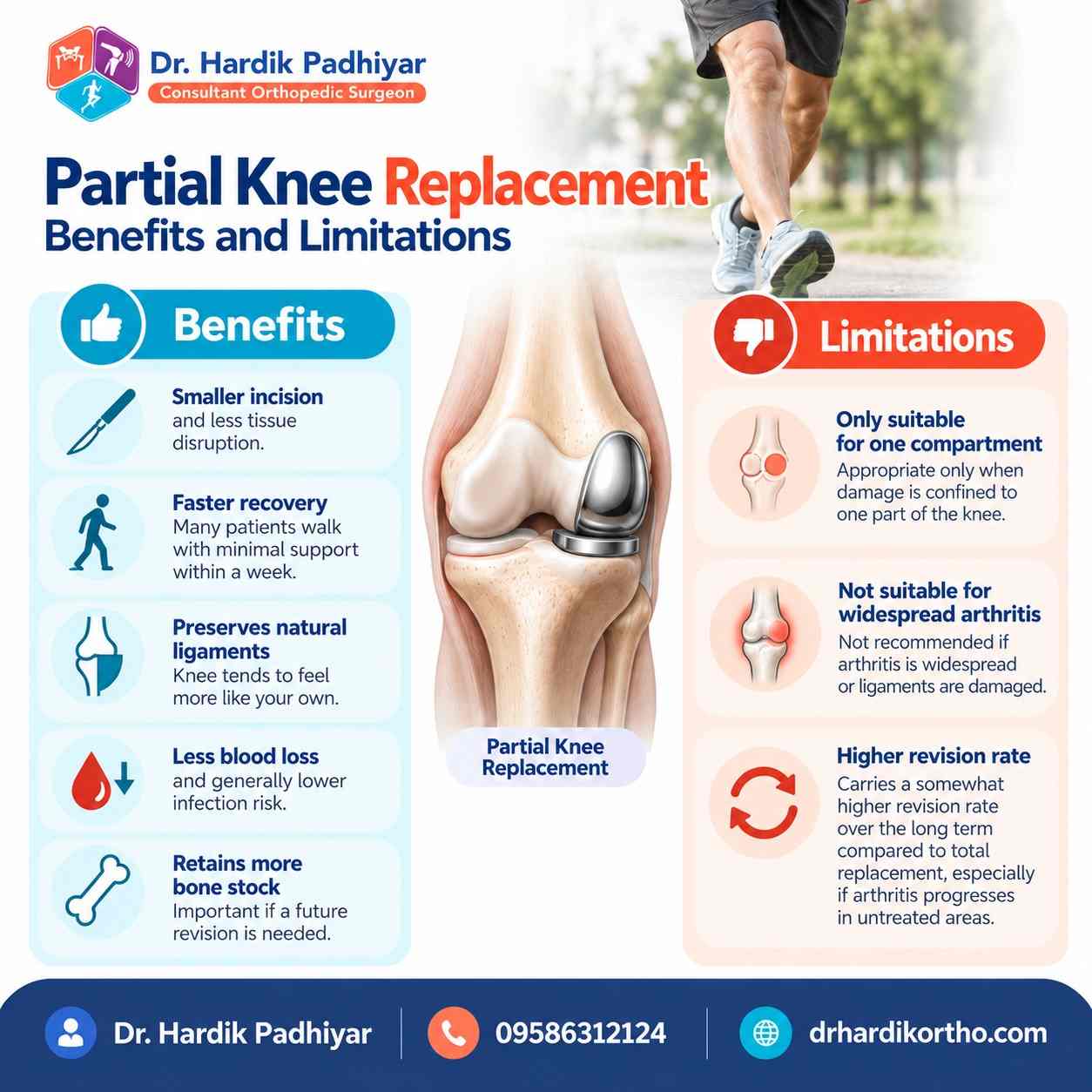 Partial Knee Replacement Benefits and Limitations