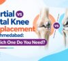 Partial vs Total Knee Replacement in ahmedabad