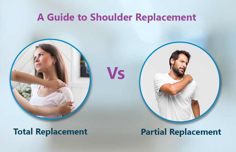 a guide to shoulder replacement- total or partial