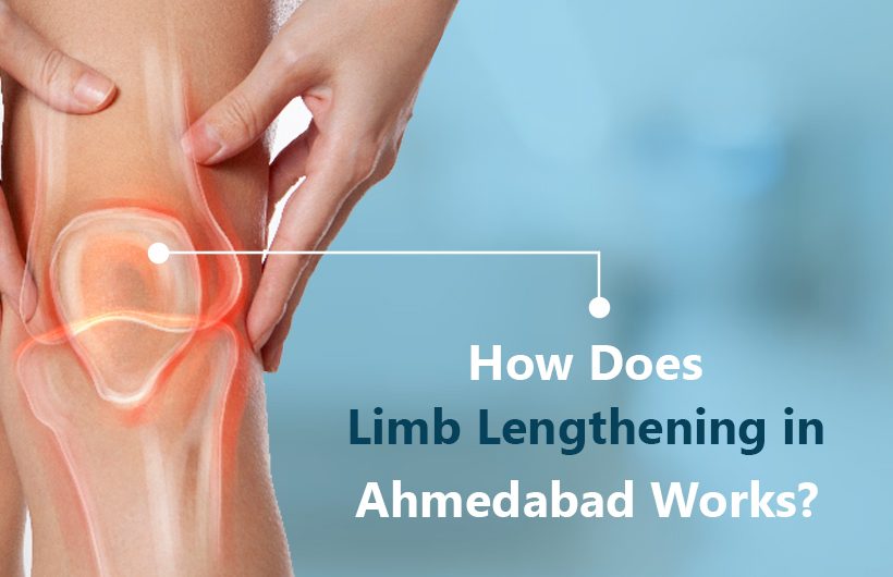 how does limb lengthening in ahmedabad works