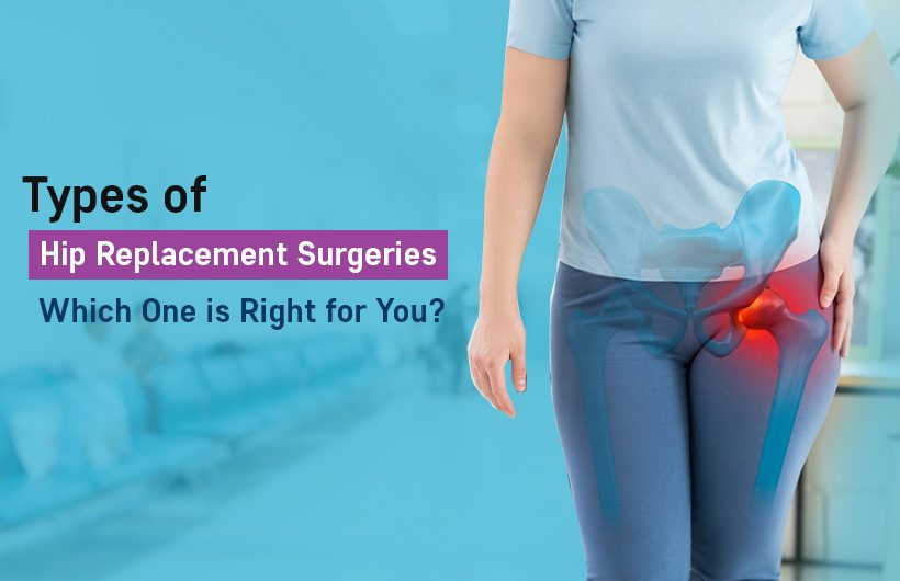 types of hip replacement